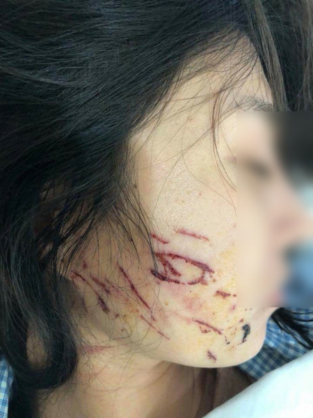 Vụ người phụ nữ bị lột đồ, đổ nước mắm ở Thanh Hóa: Báo cáo Bộ Công an về hành vi Làm nhục người khác