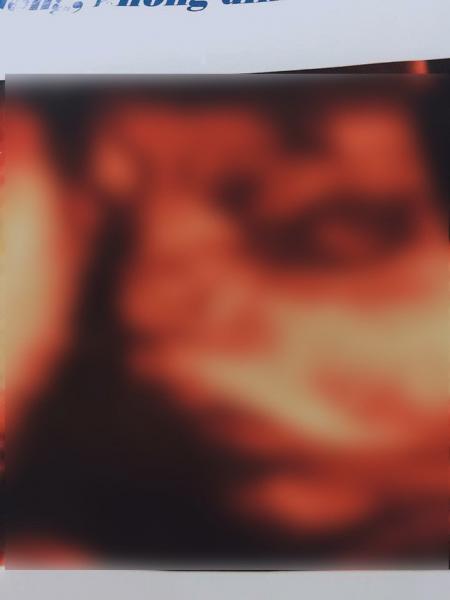 Bắc Giang: Chồng để lại tâm thư rồi uống thuốc chuột tự tử vì nghe tin vợ đang mang thai đôi bỗng mất con