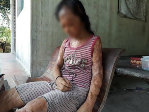 Gặp bà nội bé gái bị tạt a-xít xin đôi mắt của tử tù Nguyễn Hữu Tình - 1
