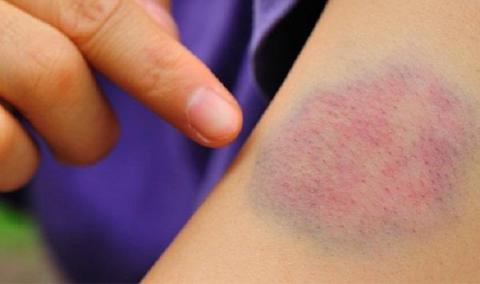 con lien tuc bi bam tim, me bi nghi mac benh nen nguoc dai con nhung su that bat ngo - 1