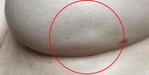 vet mau xanh dinh tren ao to cao can benh dang so nguoi phu nu dang mac phai - 2