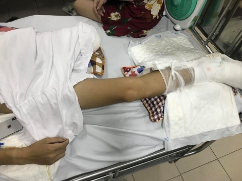 An ninh - Hình sự - Nạn nhân bị chém nát chân ở Phú Thọ kể lại giây phút kinh hoàng