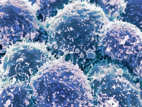 Chế tạo thành công loại virus chuyên diệt tế bào ung thư - 1
