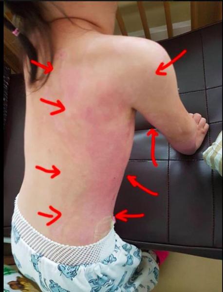 thay con gai 5 tuoi bi bong nang, bo me chet dung khi kiem tra camera truong mau giao - 3