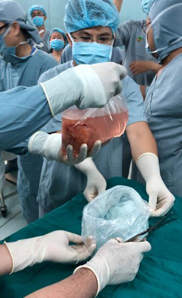 Mẹ quyết sinh con ra để lấy tạng cho người khác - 1