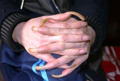 vo nhot chong vao long sat o thanh hoa: khong vao 'chuong cop' thi... hinh anh 1