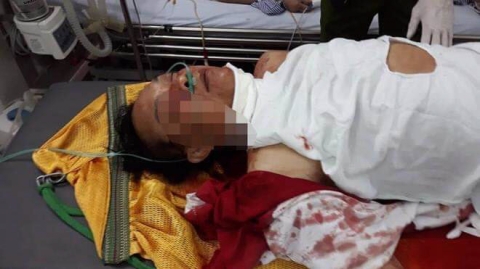 Thầy cúng gây thảm án 4 người thương vong ở Nam Định đã tử vong - 1