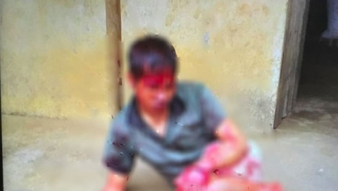 Bắc Giang: Thanh niên tâm thần bị hàng xóm chém 7 nhát vì làm đổ tường gạch và gãy cây cối trong vườn