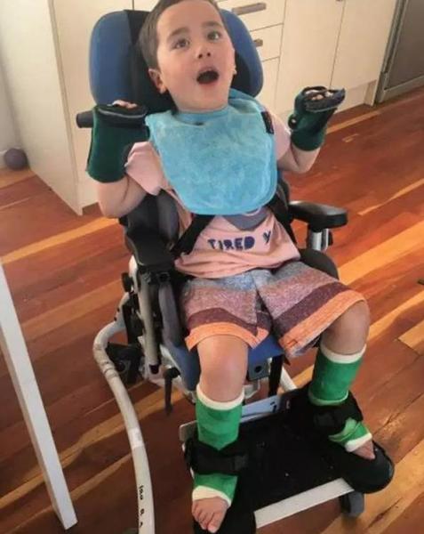 be trai gan 2 tuoi bi bai nao, khong the di lai sau khi an tao o truong mau giao - 1