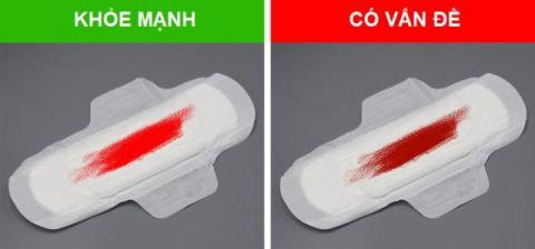 8 dau hieu tuong nhe nhung canh bao benh phu nu khong he don gian - 5