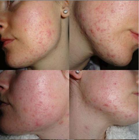 8 dau hieu tuong nhe nhung canh bao benh phu nu khong he don gian - 2