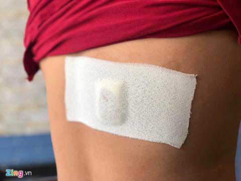 Duoi cuop o Sai Gon, nam thanh nien di xe SH khong biet minh bi dam hinh anh 1