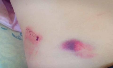 Chanh van phong Huyen uy danh tai xe nhap vien hinh anh 1 