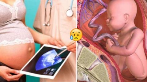 canh-bao-nhung-dau-hieu-me-thieu-canxi-bo-sung-ngay-keo-con-coi-xuong-phunuutoday