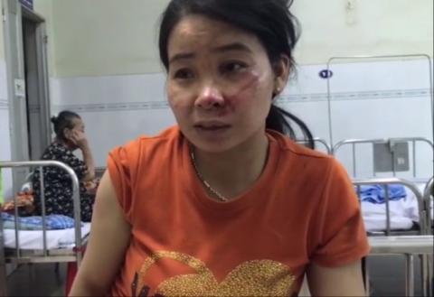 Nạn nhân kể phút kinh hoàng khi tường sập đè chết 10 người - ảnh 1