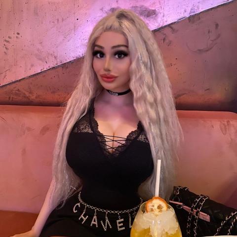 Đời sống - 9X trải qua 10 lần phẫu thuật thẩm mỹ để giống búp bê Barbie (Hình 4).