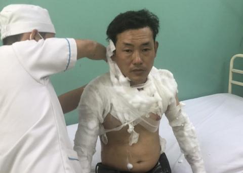 Kẻ tẩm xăng doạ đốt, cướp tiền chi nhánh ngân hàng TPBank ở Sài Gòn là ai?