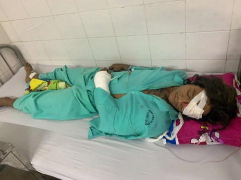 Vụ chó Pitbull cắn chết người: Chủ chó từng đi cai nghiện hơn 10 lần, nạn nhân bị chết vẫn chưa xác định được danh tính - Ảnh 3. Vụ chó Pitbull cắn chết người: Chủ chó từng đi cai nghiện hơn 10 lần, nạn nhân bị chết vẫn chưa xác định được danh tính - Ảnh 3.