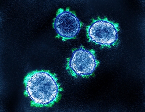 Mẫu phổi trăm tuổi hé lộ bí ẩn chết chóc của đại dịch cúm: Điều SARS-CoV-2 đang làm với vật chủ con người - Ảnh 2.