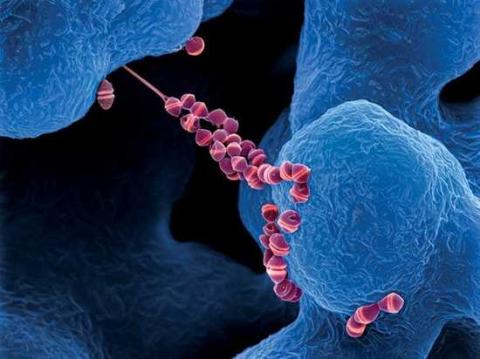 Người đàn ông tử vong chỉ sau 2 ngày sốt cao do nhiễm liên cầu lợn - Ảnh 2. Người đàn ông tử vong chỉ sau 2 ngày sốt cao do nhiễm liên cầu lợn - Ảnh 2.