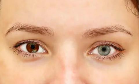 4-4-dau-hieu-ung-thu-ma-1.jpg 1