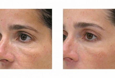 v22-xahoi.com.vn-w700-h477