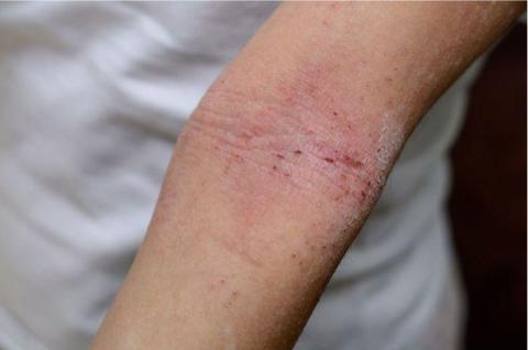 ch12-xahoi.com.vn-w1500-h995 ch12-xahoi.com.vn-w1500-h995