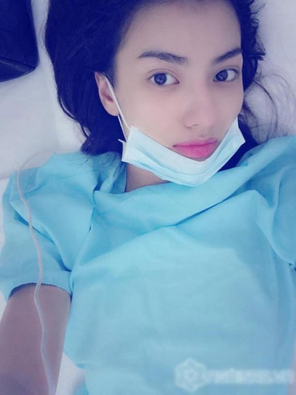 sao-viet-bi-nem-da-vi-khoe-anh-nhap-vien6