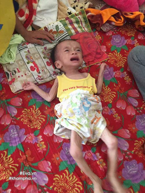 xot xa hinh anh em be sinh ra nang 4kg, sau mot nam chi con 3,4kg - 2