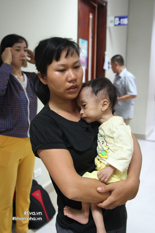 xot xa hinh anh em be sinh ra nang 4kg, sau mot nam chi con 3,4kg - 4