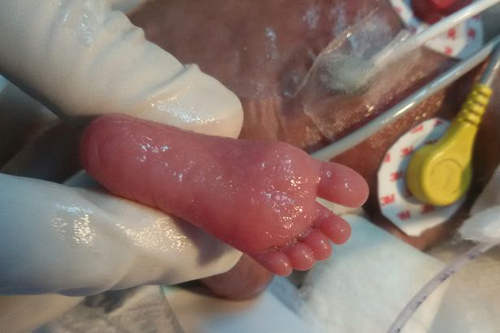 suc song ky dieu cua em be nho nhat the gioi, nang chua day 0,5kg khi chao doi - 3
