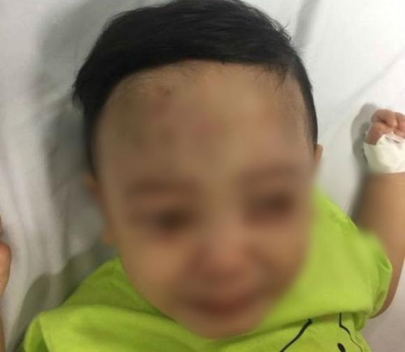 Vụ bé trai 14 tháng tuổi nghi bị bạo hành: Người mẹ buôn bán ma túy tha lôi cháu bé lang thang khắp nơi - Ảnh 2. Vụ bé trai 14 tháng tuổi nghi bị bạo hành: Người mẹ buôn bán ma túy tha lôi cháu bé lang thang khắp nơi - Ảnh 2.