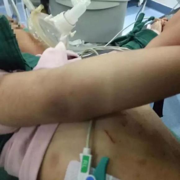 Bé gái 3 tuổi nhập viện với thương tích đầy mình và tội ác của người mẹ kế khiến dư luận phẫn nộ - Ảnh 1. Bé gái 3 tuổi nhập viện với thương tích đầy mình và tội ác của người mẹ kế khiến dư luận phẫn nộ - Ảnh 1.