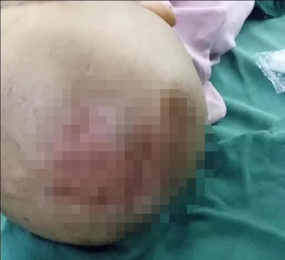 Bé gái 3 tuổi nhập viện với thương tích đầy mình và tội ác của người mẹ kế khiến dư luận phẫn nộ - Ảnh 2. Bé gái 3 tuổi nhập viện với thương tích đầy mình và tội ác của người mẹ kế khiến dư luận phẫn nộ - Ảnh 2.