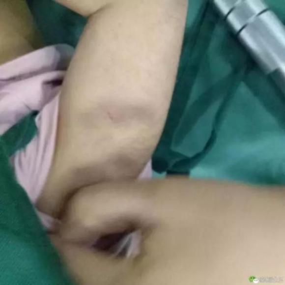 Bé gái 3 tuổi nhập viện với thương tích đầy mình và tội ác của người mẹ kế khiến dư luận phẫn nộ - Ảnh 4. Bé gái 3 tuổi nhập viện với thương tích đầy mình và tội ác của người mẹ kế khiến dư luận phẫn nộ - Ảnh 4.