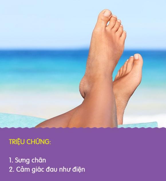 8 biểu hiện khác lạ ở chân là dấu hiệu cảnh báo có thể bạn đang gặp bệnh nghiêm trọng - Ảnh 2. 8 biểu hiện khác lạ ở chân là dấu hiệu cảnh báo có thể bạn đang gặp bệnh nghiêm trọng - Ảnh 2.