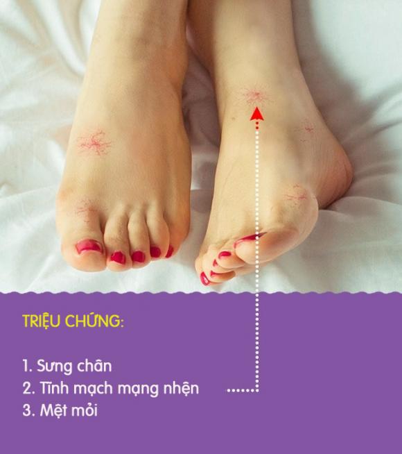 8 biểu hiện khác lạ ở chân là dấu hiệu cảnh báo có thể bạn đang gặp bệnh nghiêm trọng - Ảnh 6. 8 biểu hiện khác lạ ở chân là dấu hiệu cảnh báo có thể bạn đang gặp bệnh nghiêm trọng - Ảnh 6.