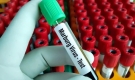 Bộ Y tế đề nghị giám sát chặt nguy cơ lây nhiễm virus Marburg vào Việt Nam
