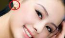 Thầy tướng số nói: Người có nốt ruồi ở đây, định mệnh giàu sang, tiền vào như nước, muốn nghèo cũng không nổi