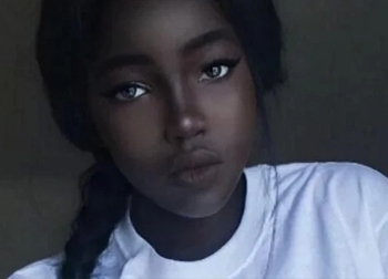 Cô gái da đen đẹp nhất thế giới, đến mức bị cha mẹ cấm ra đường, sau 5 năm cuộc sống hiện tại giờ ra sao?
