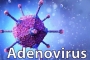 Phân biệt dấu hiệu mắc Adenovirus với bệnh cảm cúm thông thường