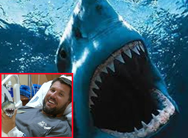 Người đàn ông xui xẻo nhất thế giới thoát hàm cá mập
