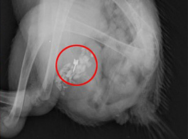  Hình ảnh chụp X-quang vị trí chiếc khuyên tai trong dạ dày Sarah.