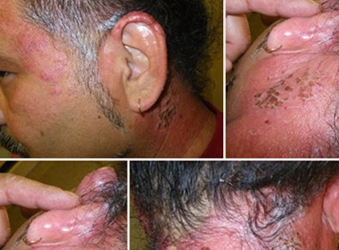 Tác hại kinh khủng của thuốc nhuộm tóc mà nhiều người bỏ qua 