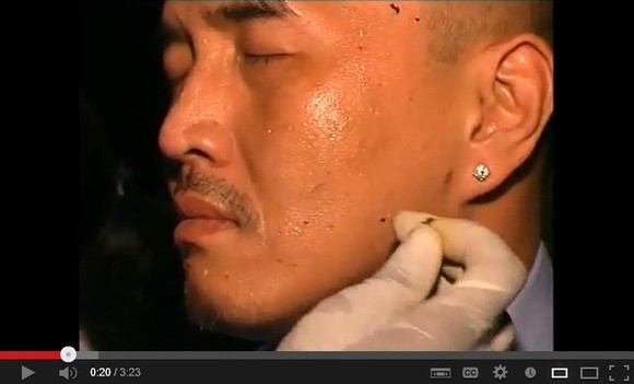ky-sinh-trung-o-nguoi-3