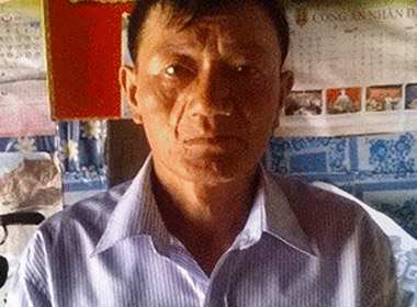Một thương binh 3 năm đi kiện đòi... 4 cái răng
