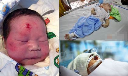 Số phận đáng thương của những em bé vừa sinh ra đã mồ côi mẹ