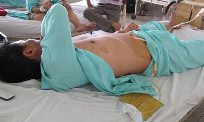 Cuộc sống vợ chồng sau các vụ cắt 'của quý': Một phút sai lầm, một đời day dứt