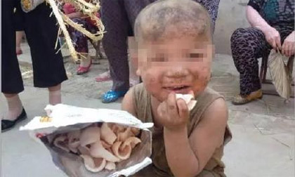 Em bé bị ngược đãi sống chung với lợn, 7 tuổi vẫn chưa biết nói