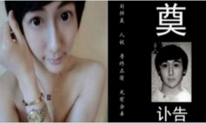 Anh chàng có “khuôn mặt yêu tinh” tự tử vì phẫu thuật thẩm mỹ thất bại?